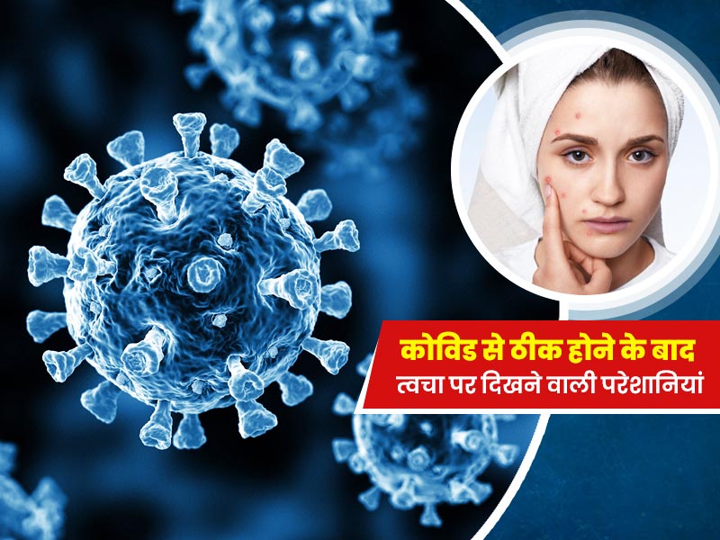 कोविड से ठीक होने के बाद बढ़ जाती हैं ये 3 स्किन प्रॉब्लम्स, डॉक्टर से जानें बचाव के टिप्स  