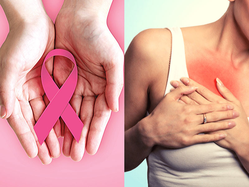 World Cancer Day 2022: महिलाओं में कैंसर होने पर दिखते हैं ये शुरुआती लक्षण, न करें नजरअंदाज