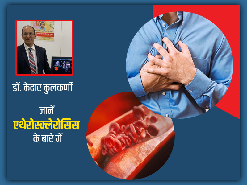 धमनियों में रुकावट (एथेरोस्क्लेरोसिस) का कारण क्या है? डॉक्टर से जानें कारण, लक्षण, इलाज