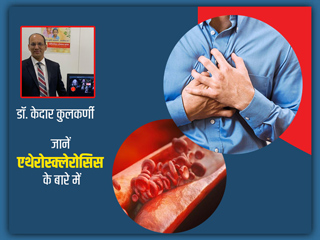धमनियों में रुकावट (एथेरोस्क्लेरोसिस) का कारण क्या है? डॉक्टर से जानें कारण, लक्षण, इलाज