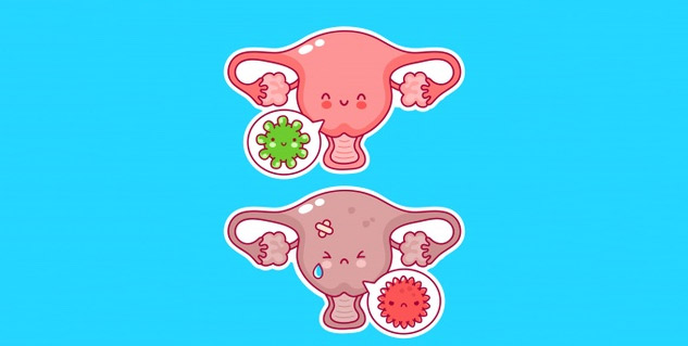 Causes of abnormal vaginal discharge