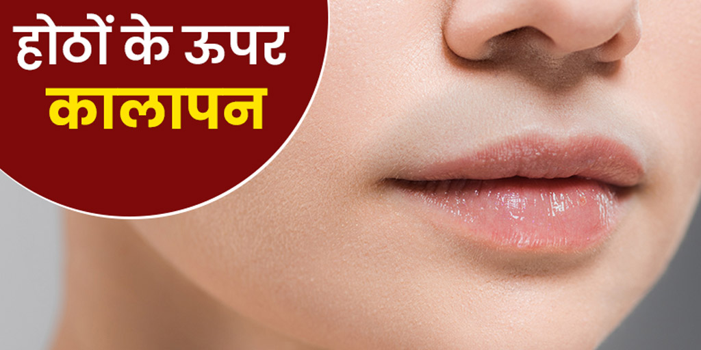 How to Get Rid of Sun Mustache or Upper Lips Darkness in Hindi होठों