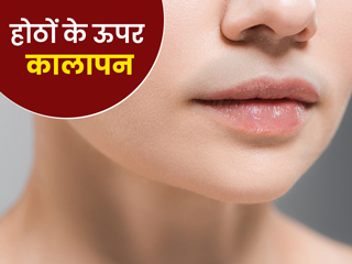 होठों के ऊपर कालेपन (मूंछ जैसा) से परेशान हैं, तो इसे दूर करने के लिए अपनाएं ये 4 उपाय