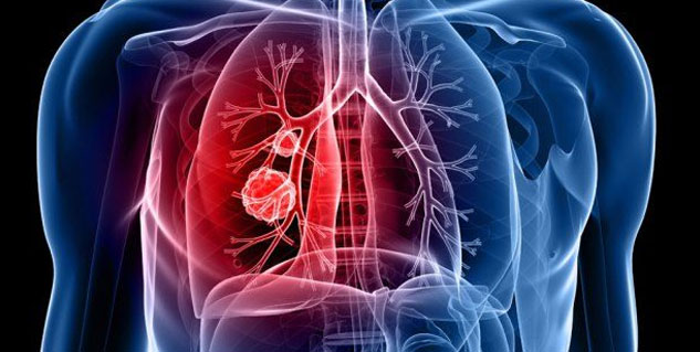 pneumonia and diabetes