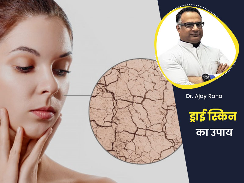 सर्द हवा बढ़ाती है त्वचा में खुश्की और खुजली, एक्सपर्ट से जानें ड्राई स्किन के लिए खास टिप्स