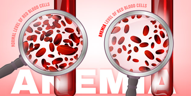anemia