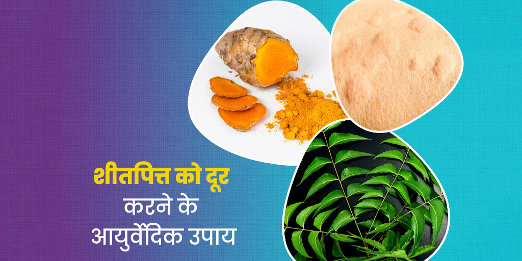 ayurvedic-treatment-of-sheetpitta-or-urticaria-in-hindi