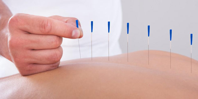 acupunture