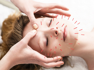 World Acupuncture Day 2021: एक्यूपंचर क्या है? जानें इस विधि से इलाज के 5 फायदे और नुकसान