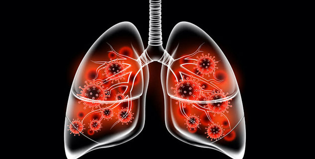 What Is The Link Between COPD And Air Pollution? Know Expert Tips To ...