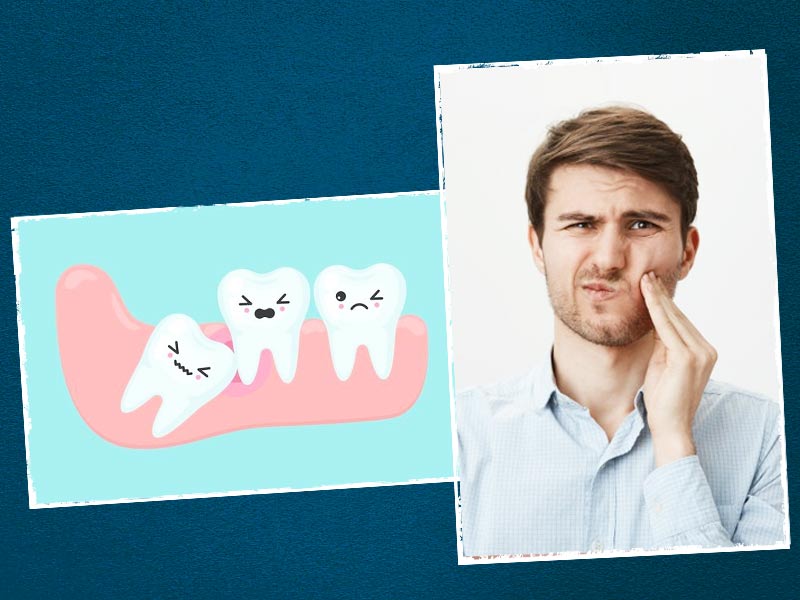Debunked! Myths About Wisdom Teeth That You Might Be Believing