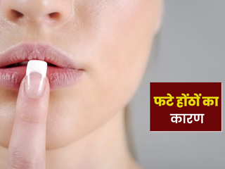 मॉइस्चराइजर लगाने के कुछ घंटे बाद ही फट जाते हैं आपके होंठ? शरीर में हो सकती है इन 4 विटामिन्स की कमी
