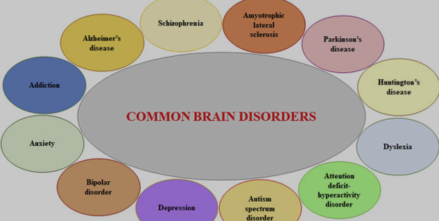 Different Types Of Brain Diseases And Disorders You Should Know About Onlymyhealth