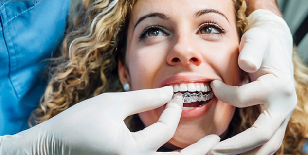 Pros of Invisible Aligner 