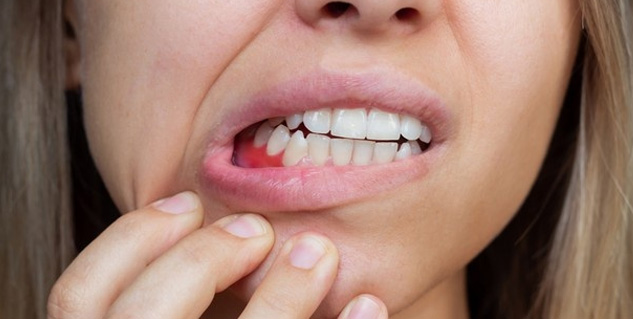  Asthma-And-Oral-Health