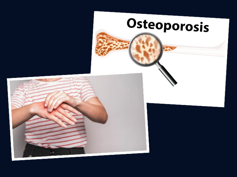 Osteoporosis Cases Rising in Young Women, Watch Out For These Early Warning Signs