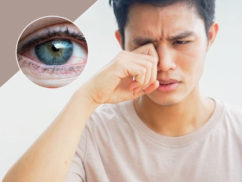 Know About 5 Winter Eye Problems That Are Common In The Cold Season