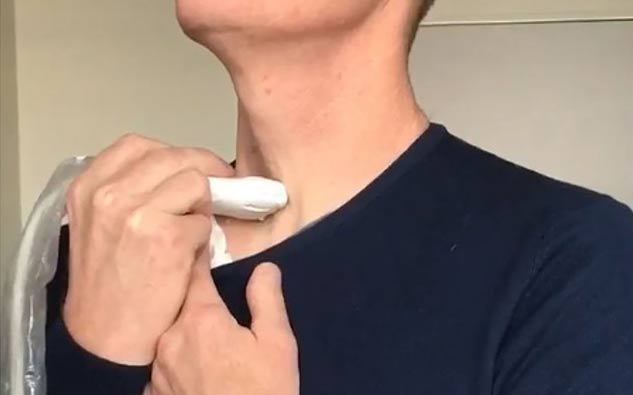 thyroid_surgery