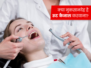 क्या रूट कैनाल करवाने से कैंसर हो सकता है? एक्सपर्ट से जानें सच्चाई