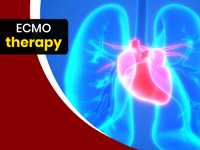 ECMO Therapy For Lungs: Know How It Can Help In Post Covid Lung Recovery