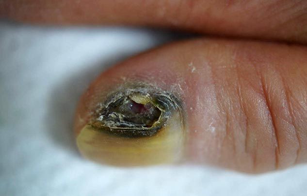 insideNAILS