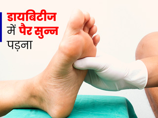डायबिटीज रोगी पैर सुन्न पड़ जाने को न करें नजरअंदाज, एक्सपर्ट से जानें कारण और बचाव के टिप्स