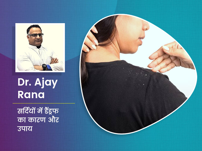 सर्दियों में डैंड्रफ का कारण बनती हैं आपकी ये 5 गलतियां, डर्मेटोलॉजिस्ट से जानें 10 टिप्स जो दूर करेंगी रूसी