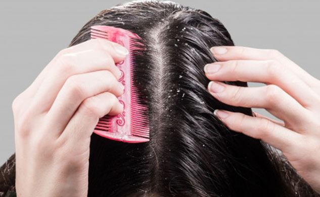 insidedandruffinhairs