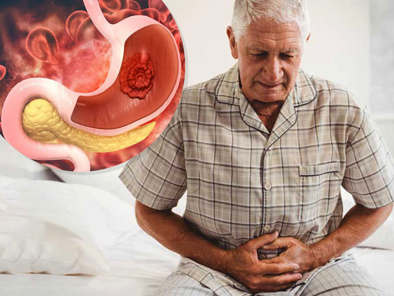 7 Myths About Stomach Cancer Debunked, Know Real Facts Behind It