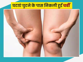घुटने के आसपास चर्बी खराब करती है आपके पैरों की खूबसूरती, इसे कम करने के लिए करें ये 5 एक्सरसाइज