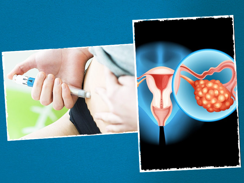 What Is Ovarian Stimulation in IVF? Know Its Relation To Fertility