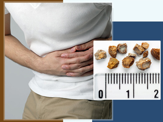 किडनी स्टोन होने पर कौन सी सब्जियां खाएं और कौन सी नहीं? डाटीशियन से जानें विस्तार से