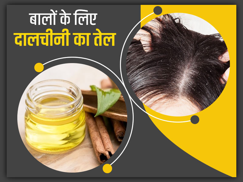 सिर में है पपड़ीदार रूसी की समस्या तो इस्तेमाल करें दालचीनी का तेल, जानें बालों के लिए इसके 6 फायदे