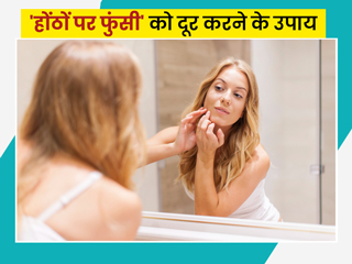 होंठों पर फुंसी होने पर अपनाएं ये 6 घरेलू उपाय
