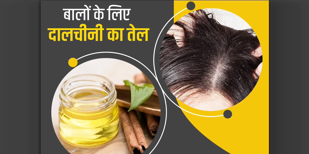 Cinnamon oil benefits for hair in hindi सिर में है पपड़ीदार रूसी की