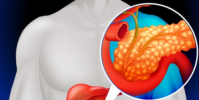 Insulin is a hormone produced by the pancreas