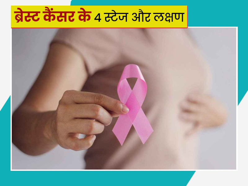ब्रेस्ट कैंसर (स्तन कैंसर) के होते हैं ये 4 स्टेज, डॉक्टर से जानें किस स्टेज में कौन से लक्षण दिखते हैं