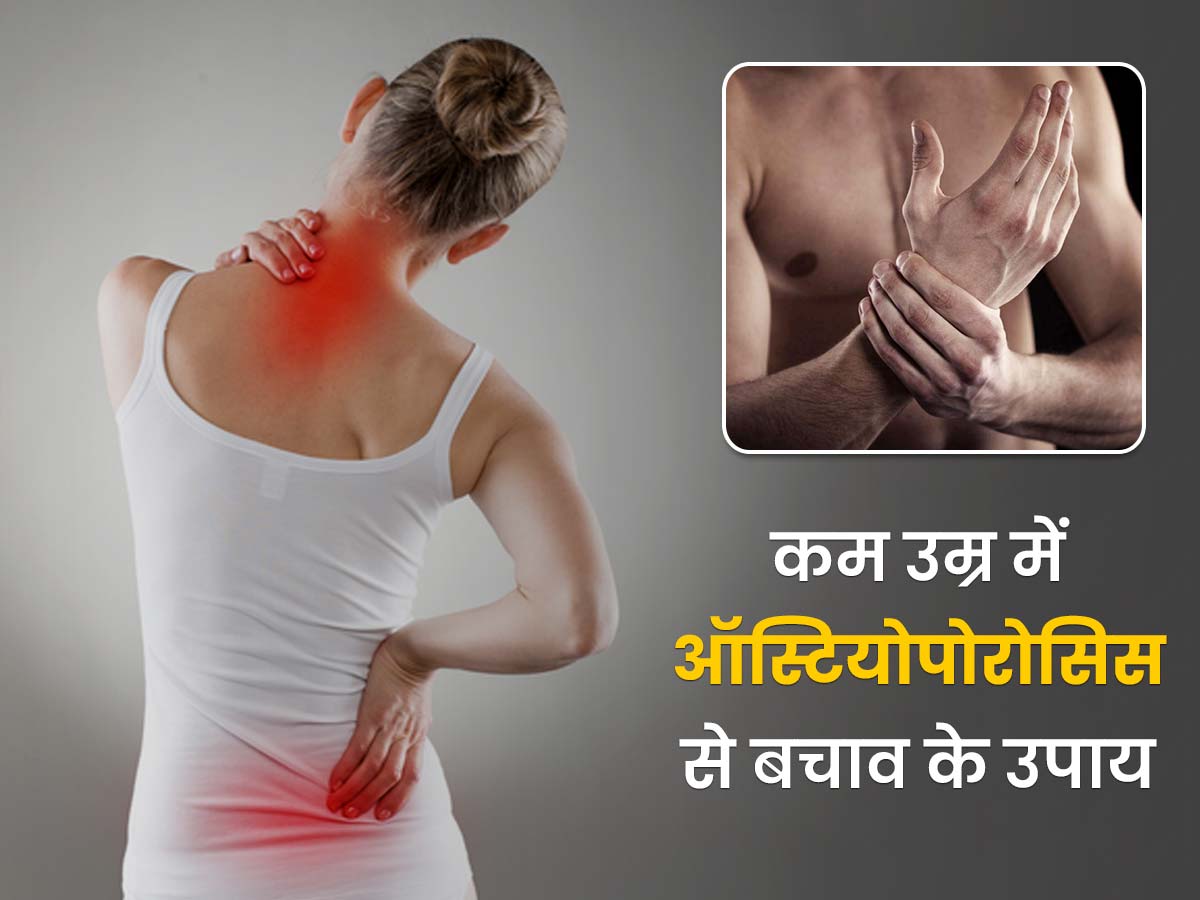 ऑस्टियोपोरोसिस से बचना है तो 20-30 की उम्र में इन 10 बातों का रखें ध्यान