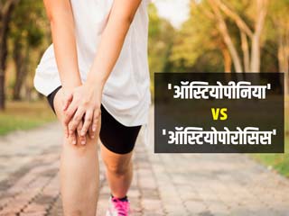 ऑस्टियोपीनिया और ऑस्टियोपोरोसिस दोनों हैं हड्डियों से संबंधित समस्या, जानें दोनों के बीच का अंतर 
