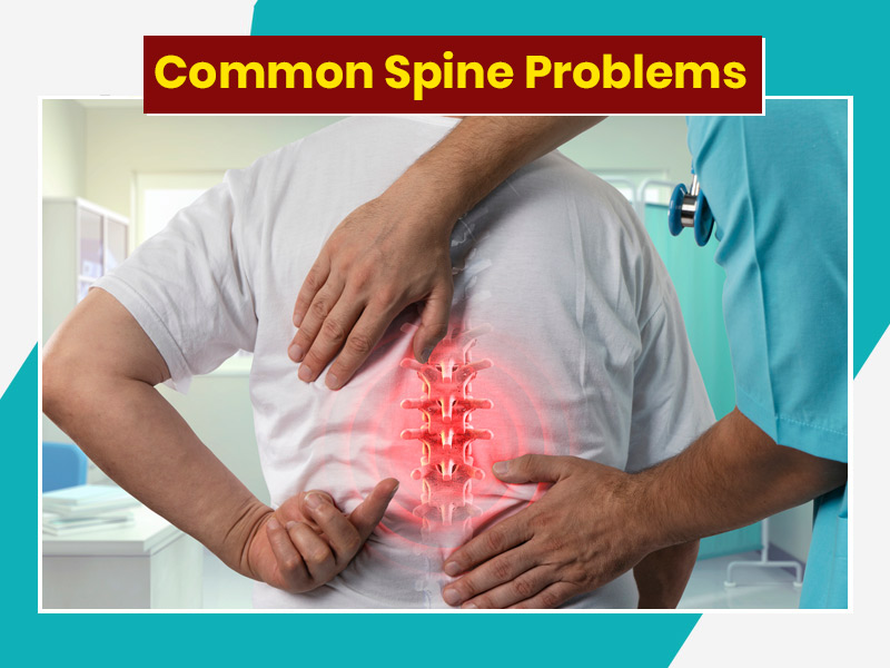 7 Common Spine Issues That Can Happen To Anyone, Know How To Cope Up ...