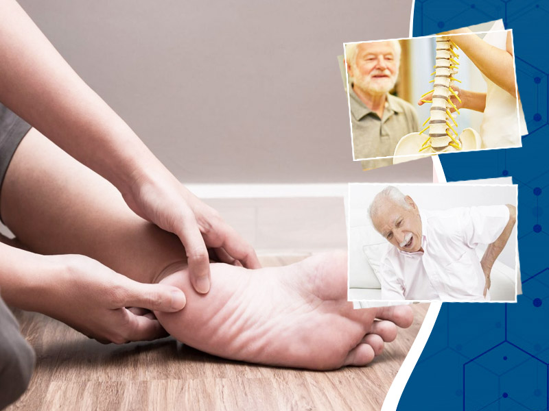 Bone Spurs: All You Need To Know About This Bone Disorder | OnlyMyHealth