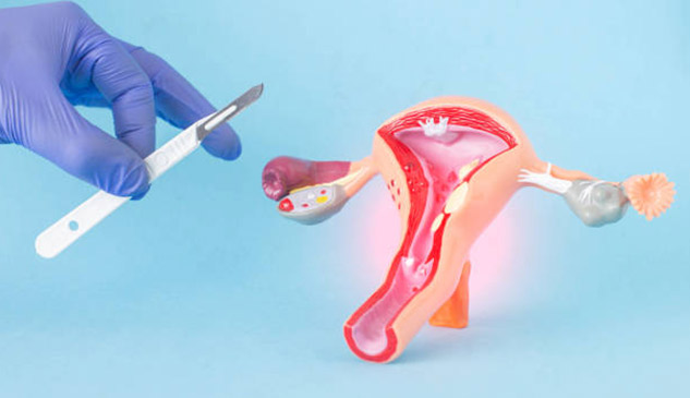 Hysteroscopy-Procedure-Uses-Risks