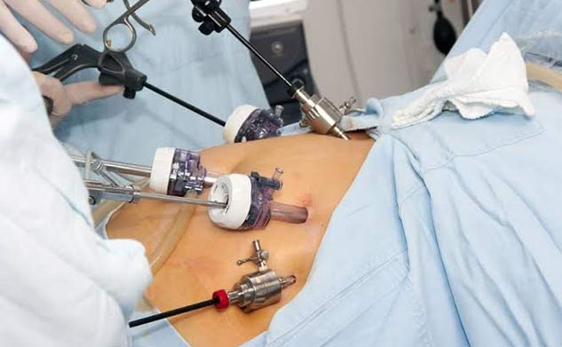bariatric surgery