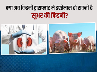 इंसान में सुअर की किडनी लगाने में कामयाब हुए अमेरिकी डॉक्टर्स, मेडिकल साइंस में जल्द आ सकती है नई क्रांति