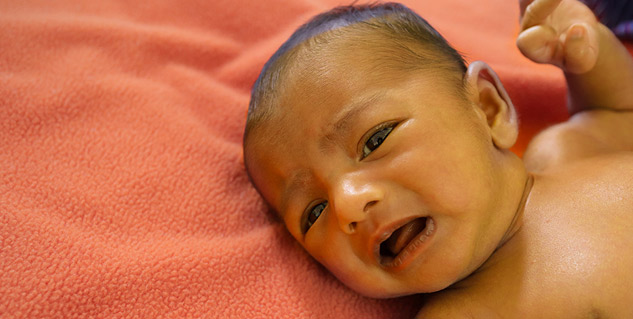 baby_suffering_from_jaundice
