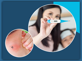 Dengue Rashes: स्किन पर चकत्ते भी हो सकते हैं डेंगू के लक्षण, डॉक्टर से जानें डेंगू रैशेज के लक्षण और इलाज