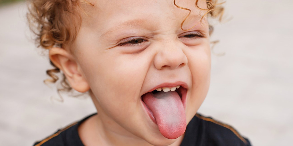 Does Your Child Have Yellowish Tongue? Know Symptoms, Causes And