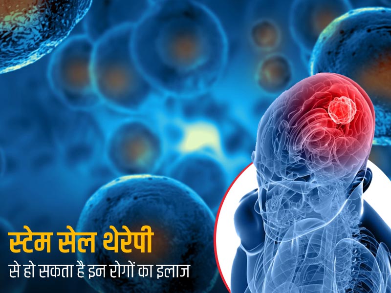 स्टेम सेल थेरेपी से कौन कौन सी बीमारियां ठीक हो सकती हैं? जानें क्या है इलाज की ये एडवांस तकनीक