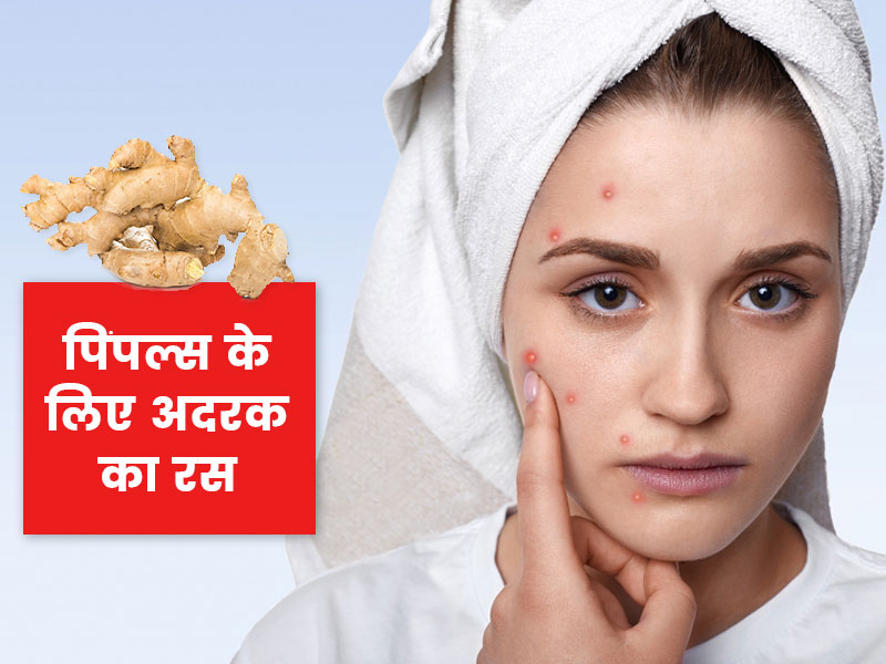 डार्क स्पॉट्स और पिंपल्स से छुटकारा पाने के लिए अदरक के रस का इन 4 तरीकों से करें इस्तेमाल