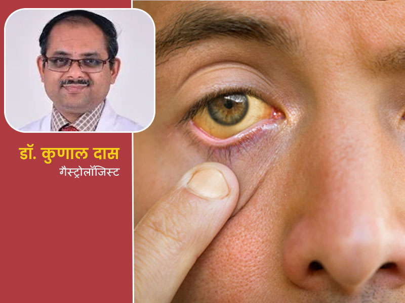 क्या पीलिया में दूध पी सकते हैं या पीलिया कितने पॉइंट होना चाहिए? जानें इस रोग से जुड़े ऐसे 8 सवालों के जवाब